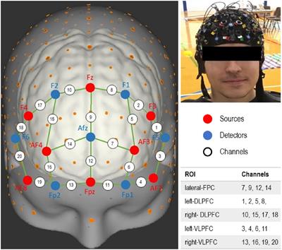 Motor learning in developmental coordination disorder: behavioral and neuroimaging study